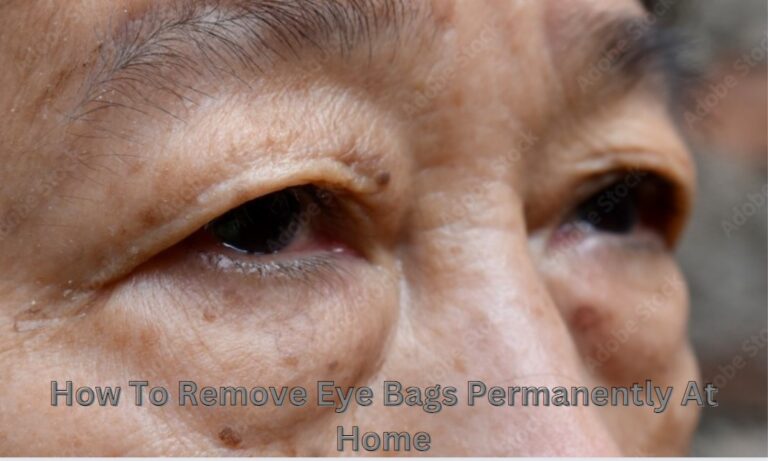 How To Remove Eye Bags Permanently At Home